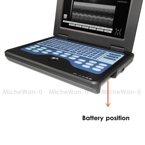 CMS600P2 Portable Laptop Machine Digital Ultrasound Scanner 3.5 Convex Probe CE - Picture 4 of 11