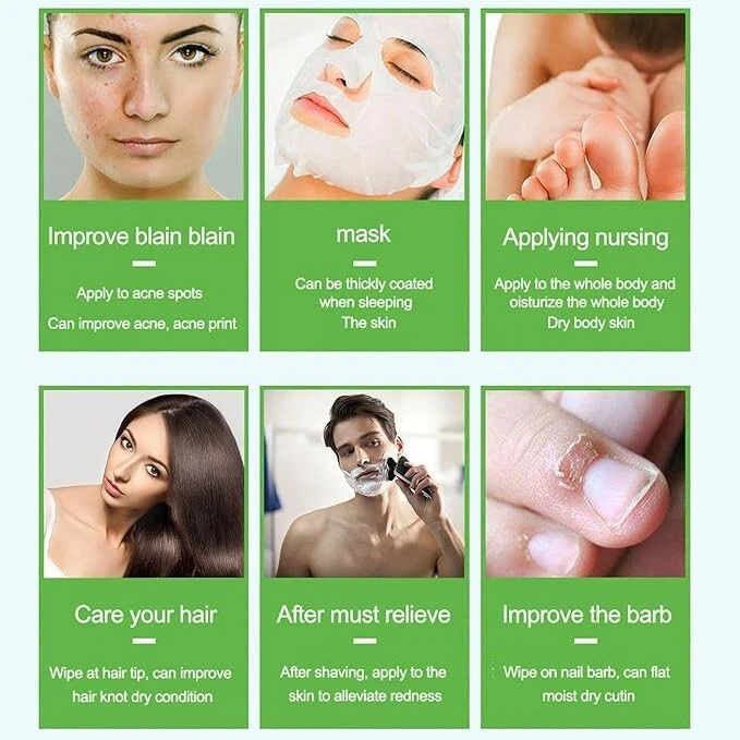 Gel calmante de aloe vera 100 % puro hidratante para rostro y cuerpo 10,58 oz / 300 ml Foto 4 de 4