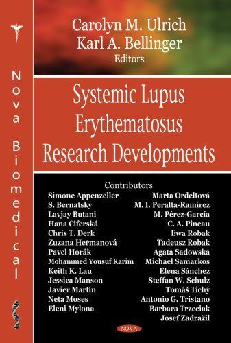 Systemic Lupus Erythematosus Research Developments (Hardcover)
