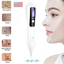 Electric Laser Pen Removal Plasma Mole Dark Spot Remover Skin Wart Tag Tattoo