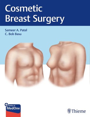 Cosmetic Breast Surgery Plus Online at MedOne Videos Sameer A. Patel (u. a.)