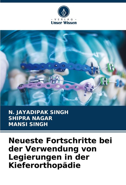 Neueste Fortschritte Bei Der Verwendung Von Legierungen In Der KieferorthopäDie-image