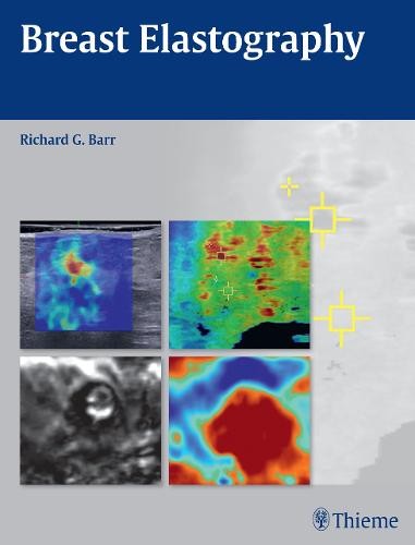 Breast Elastography Barr Hardback John Wiley & Sons 9781604068528