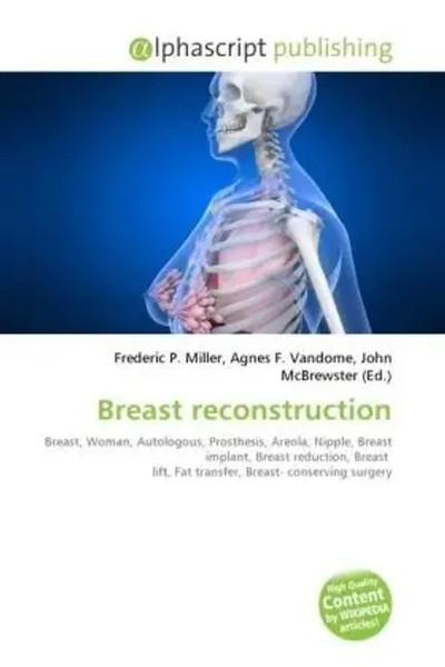 Frederic P. Miller (U. A.) | Breast Reconstruction | Taschenbuch | Englisch-image