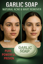 Garlic Soap help remove Acne, Moles ,Warts, Anti-Aging, Safe Remedy  2X 100GM