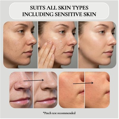 Facial Peeling Gel for Smooth, Radiant Skin - 4.05 Oz