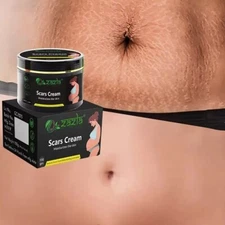 Best Scar Removal Anti-Stretch Marks Cream (100 g) For Men And Women