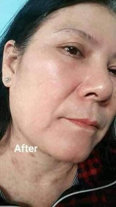 Dr. Alvin Professional Skin Care Formula Original Rejuvenating Set US Seller