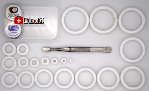 Phimosis Treatment At Home Without Surgery Cure Resolve Tight Foreskin 22 Rings