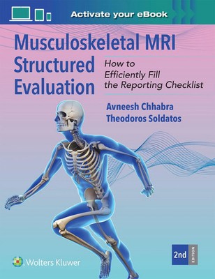 Avneesh Chhabra (u. a.) | Musculoskeletal MRI Structured Evaluation | Buch