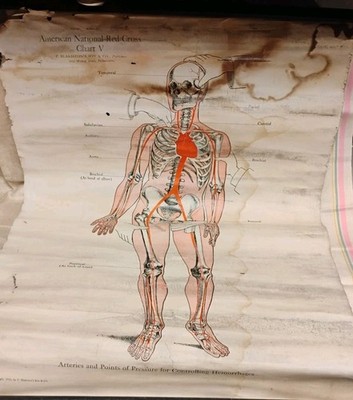 Antique 1910 American Red Cross Chart V Scroll Wall Hanging Anatomy First Aid 