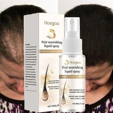 30ml Hair Growth Spray, Hair Regrowth Hair Thickening Spray for Thinning Hair