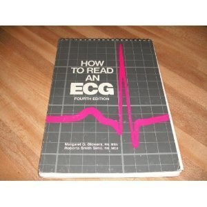 How to Read an Ecg