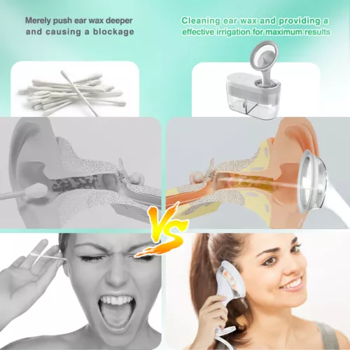 Electric Ear Water Cleaner Ear Wax Remover Ear Washer Earwax Cleaning Kit Tool - Picture 9 of 18