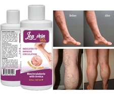 Natural Ointment Varicose Veins Vasculitis Support Foot Care Cream USA spider