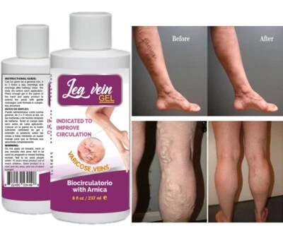 LEG VEIN Natural Ointment Varicose Veins Vasculitis Support Foot Care Cream USA spider