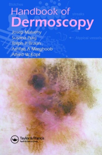 Handbook of Dermoscopy by Alfred W. Kopf PAPERBACK 9780415384902