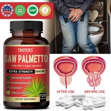 Saw Palmetto Oil for Prevent Hair Loss for Hair Growth,PROSTATE SUPPORT-120 caps