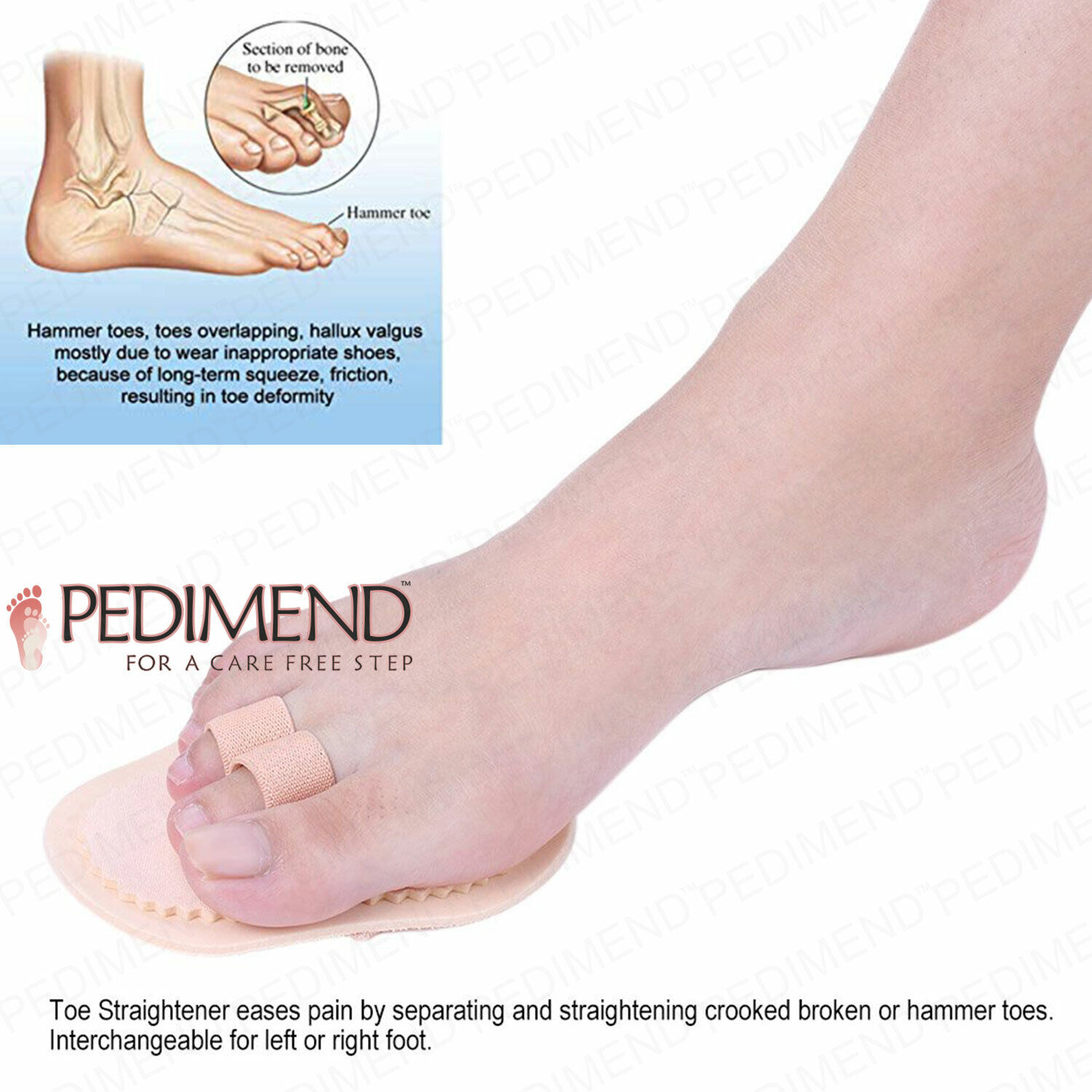 PEDIMEND™ Fabric Metatarsal Pads - Hammer Toe Straightener - Foot Care ( 2  PCS) | eBay