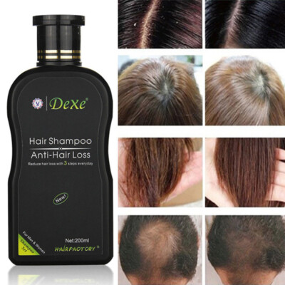 Dexe Original Anti-Hair Loss Shampoo Natural Herbal Hair Growth Treatment 200ml