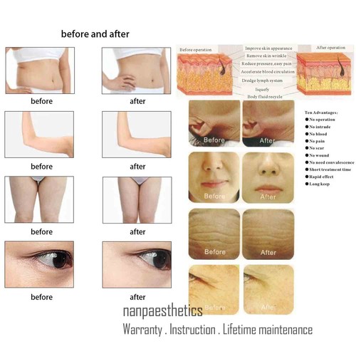 Macchina professionale per terapia RF Tecar fisioterapia antidolorifico massaggio corpo - Foto 20 di 20