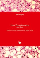 Hesham Abdeldayem (U. A.) | Liver Transplantation | Buch | Englisch (2012)