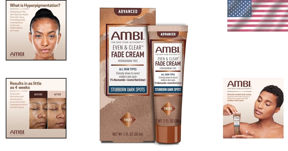 Crema blanqueadora aclaradora para manchas oscuras AMBI Skin blanqueadora blanqueadora para manchas oscuras Foto 2 de 4