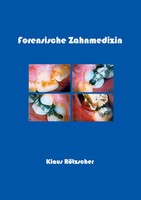 Klaus RöTzscher | Forensische Zahnmedizin | Taschenbuch | Deutsch (2003)
