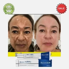 Dark Spot Melasma Hyperpigmentation Freckles Spots Removal Face Cream Effective