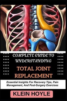 Complete Guide to Understanding Total Joint Replacement: Essential Insights For 