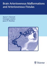 Brain Arteriovenous Malformations and Arterio...