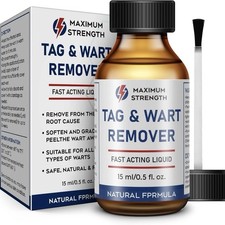 15ML Skin Tag Removal Kit Fast Acting Wart Freeze Off Corn Genital Wart