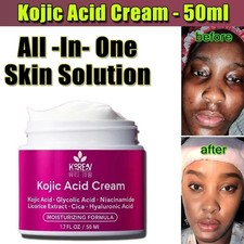 Whitening Freckle Cream Niacinamide Remove Dark Spot Cream Anti Freckle 50ml