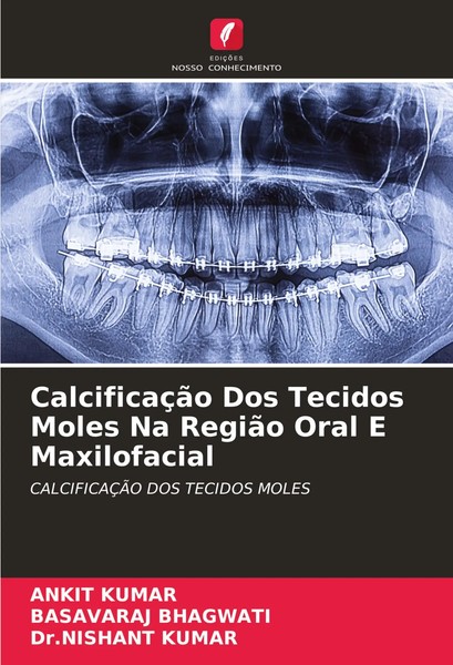 Ankit Kumar (U. A.) | CalcificaçãO Dos Tecidos Moles Na RegiãO Oral E...-image
