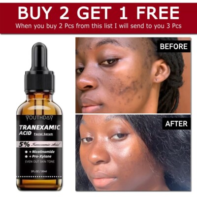 5% Tranexamic Acid Serum for Face - 1 fl oz / 30ml - Skin Brightening Serum