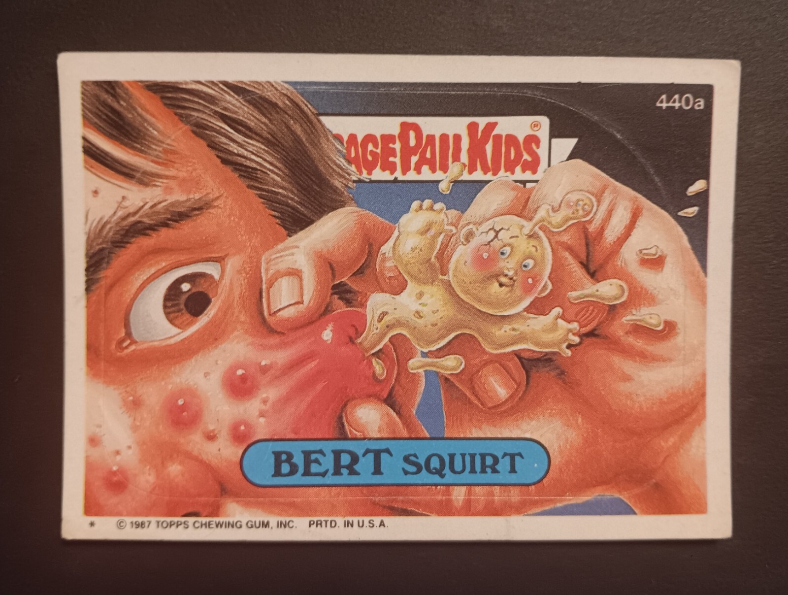 1987 Topps Garbage Pail Kids Sticker 440a Bert Squirt Near Mint Condition