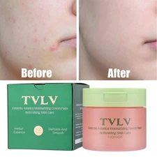 100PCS Korean Skincare Anti-Aging, Dark Spot & Wrinkle Minimizing Toner Pads