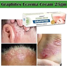 SKIN OINTMENT BODY PSORIASS DERMATITIS ECZEMA NATURAL TREATMENT CREAM 25G