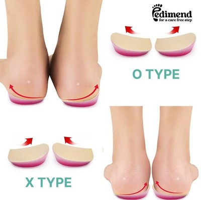 Pedimend™ Knock-Knee Bow Leg Correction Orthotic Shoes Pads for