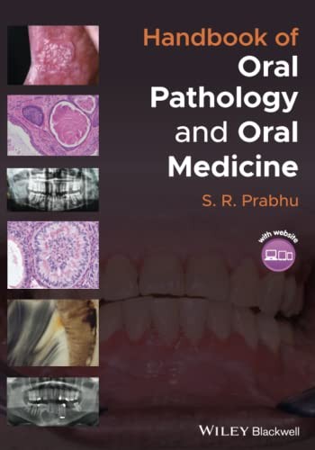 Handbook of Oral Pathology and Oral Medicine by S.R. Prabhu Paperback NEW - Image 5