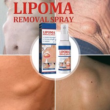 50ML Lipomheilung Reduction Spray, Instant LumpFree Lipoma Removal Spray USA Hot
