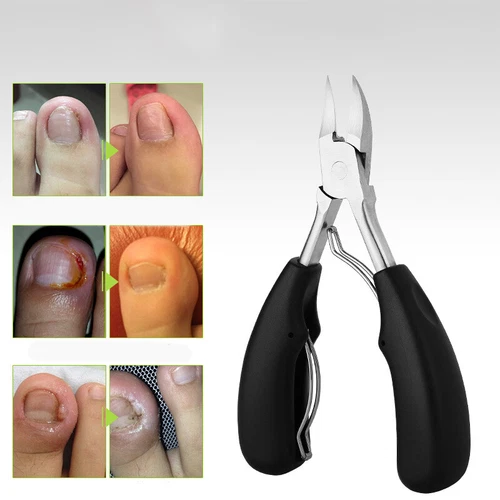 Toe Nail Clippers Remove Dead Skin Nail Correction Nippers Cuticle Scissors - Picture 5 of 7