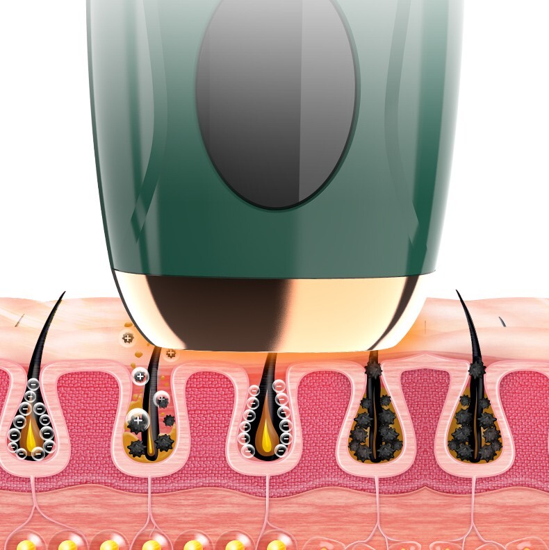 光脱毛器IPL PHOTON REJUVENATION DEPOLATOR IPL Photon Rejuvenation and Hair Removal Apparatus, Hair Removal