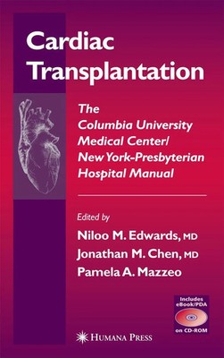 Niloo M. Edwards (u. a.) | Cardiac Transplantation | Taschenbuch | Englisch