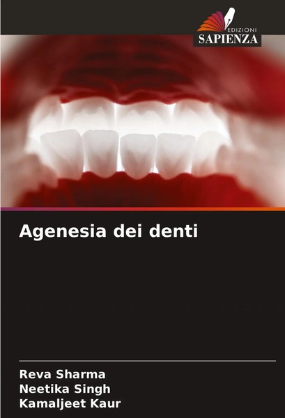 Reva Sharma (U. A.) | Agenesia Dei Denti | Taschenbuch | Italienisch (2024)-image