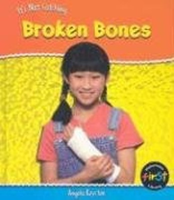 Broken Bones Hardcover Angela Royston