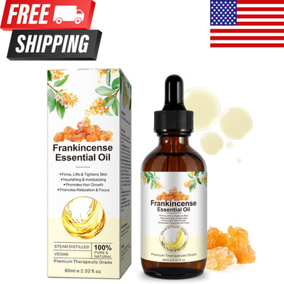 Frankincense Essential Oil 60ml 100% Pure Natural Aromatherapy Diffuser SkinCare