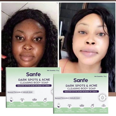 #ad #ad 🥰 BEST EXTREME whitening Face Soap no need face cream Result In 1 To 2 Pack C $35.99