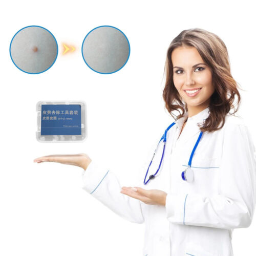 20Pcs Replacement Warts Rubber Ring 0.5/1/1.5MM For Skin Tag Mole Wart Removal - Picture 7 of 13