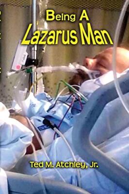 Being a Lazarus Man                                                            